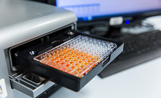 Carbonyl reductases (kit C)